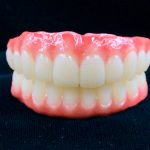 Ceramic Teeth Implant