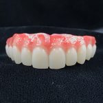 Ceramic Teeth Crown